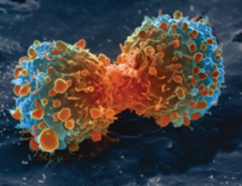 MDAlertSTAT's tweet photo. Large Study Finds that Exercise Reduces Risk of Developing 26 Cancers @JAMAInternalMed  https://t.co/8XCDoeBxxr https://t.co/YAk6eAsBOD