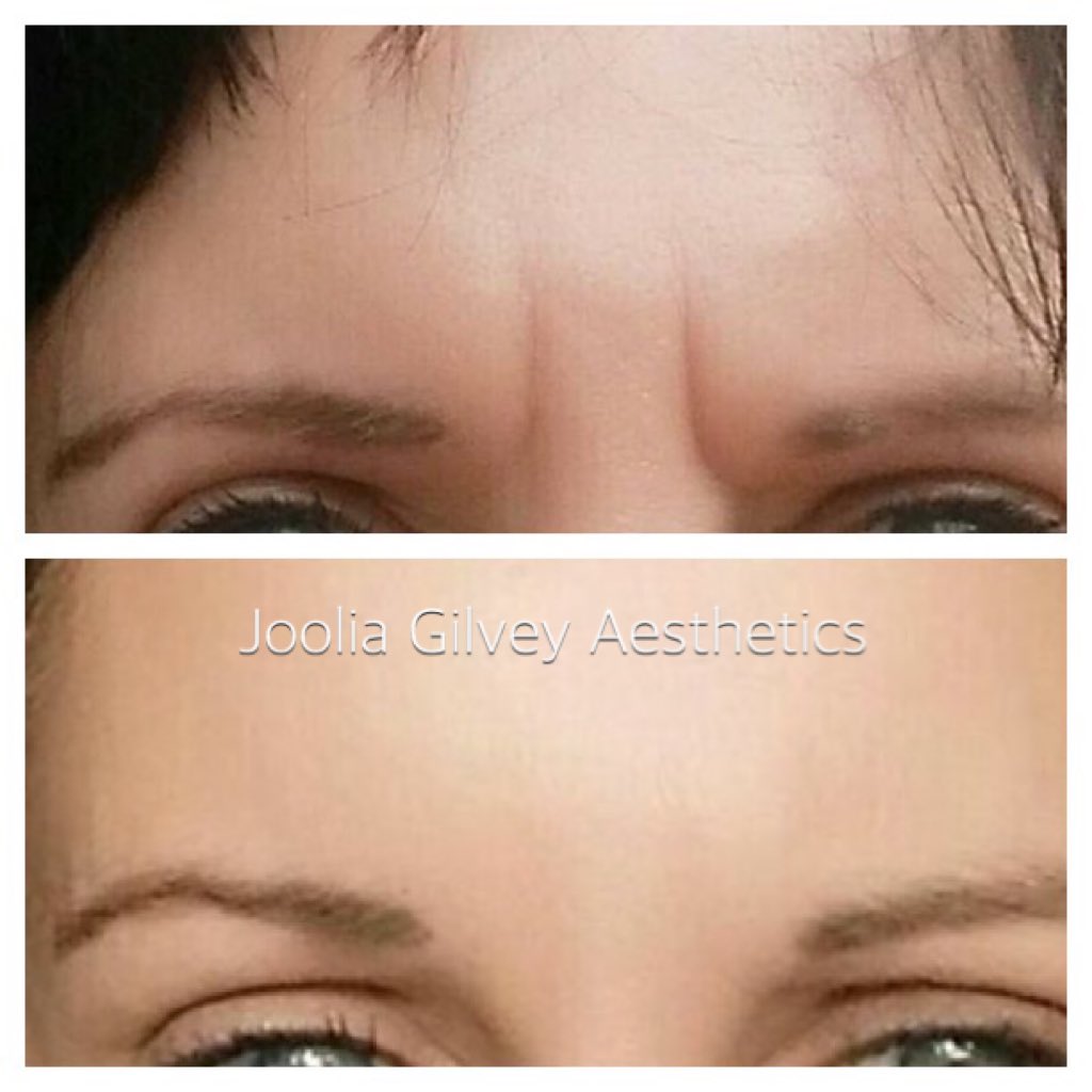 Jooliagilvey's tweet image. Results by @Jooliagilvey @PerfecthaUK @SaveFaceUK @cd_sinclair