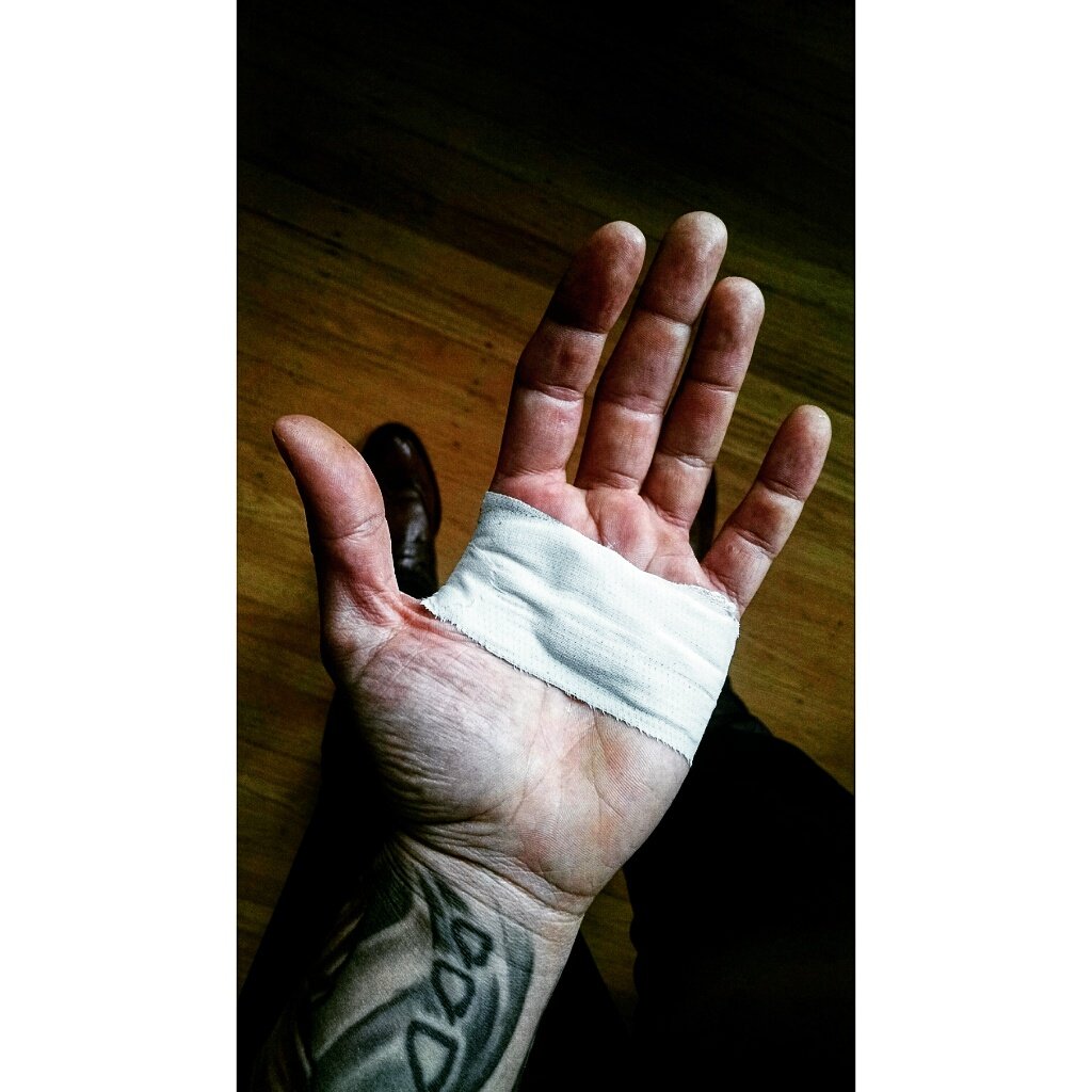 Worst one yet.
#bouldering #climbinghands #ouch #flapper