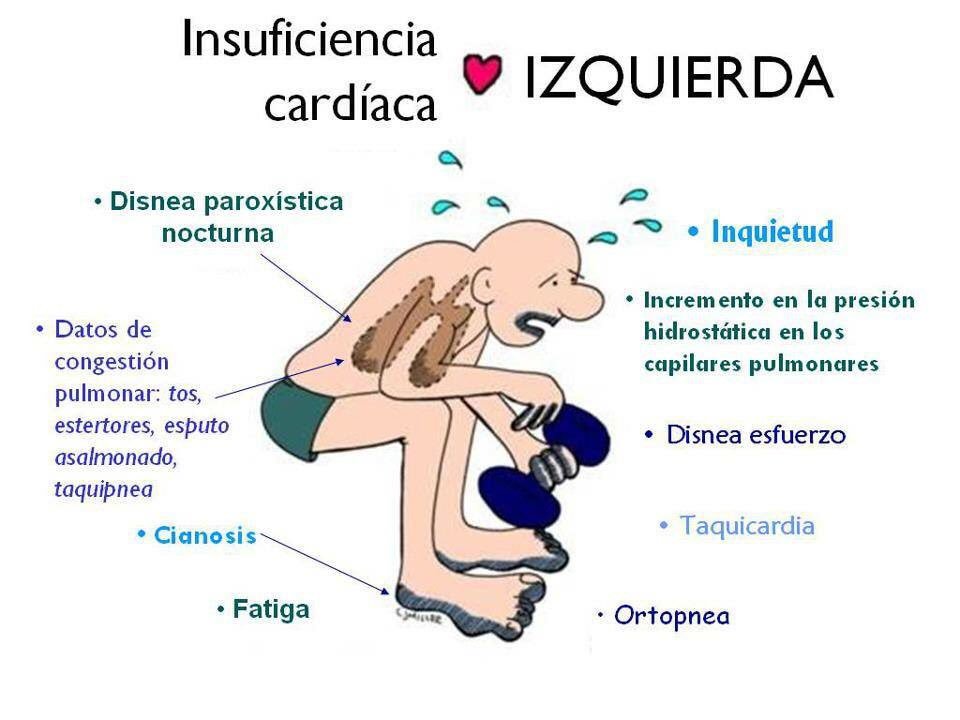 javhermor's tweet photo. Muchos corazones azules estáis con la gran "querida" cardio. ¿Repasamos las insuficiencias? Buenos días campeon@s 💙 https://t.co/ZwJXSxBK9y