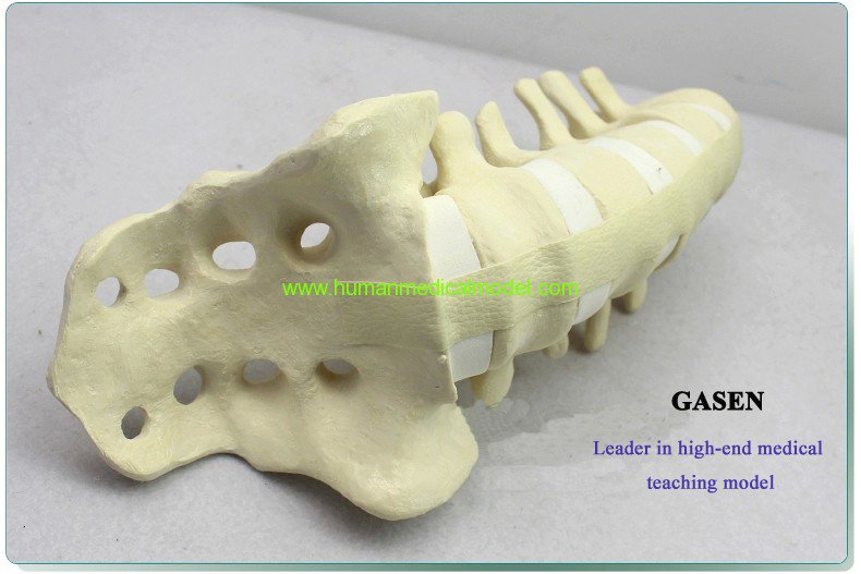 fwhvivienne's tweet photo. SURGERY AND LUMBAR MODEL-GASEN-FZG005 https://t.co/m9nW97GCSo