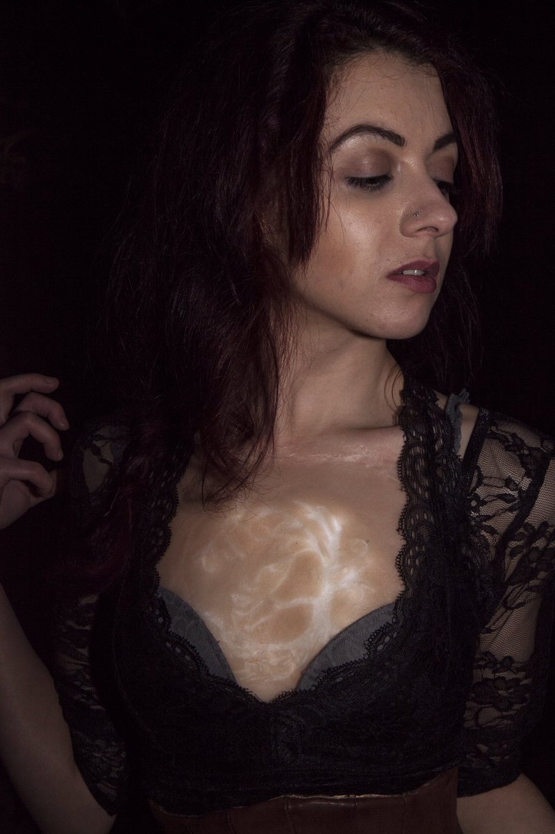 niallmccaffrey3's tweet image. FMP
Prosthetics - Niall McCaffrey-Cassidy.
Photography - Lilia Strojec.
#prosthetics #lcfperformance #makeup #LEDs