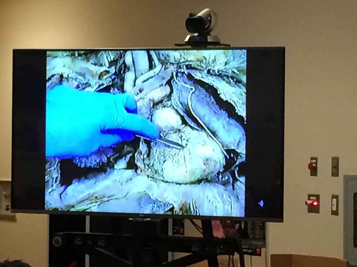 KSS gr12s VFT U of St. Louis 4 autopsy. <a href="/KevinKaardal/">Kevin Kaardal</a> @MoyraBaxter <a href="/BCBlended/">BC Blended Learning</a> @jonrever <a href="/TerryBeaudry/">Terry Beaudry</a>