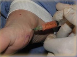 ClinicaPiqueras's tweet photo. Artículo del doctor Francisco Piqueras,  cómo solucionar la perdida de grasa en los #pies https://t.co/n8izMlKcF4 https://t.co/EdfOsOvyQa