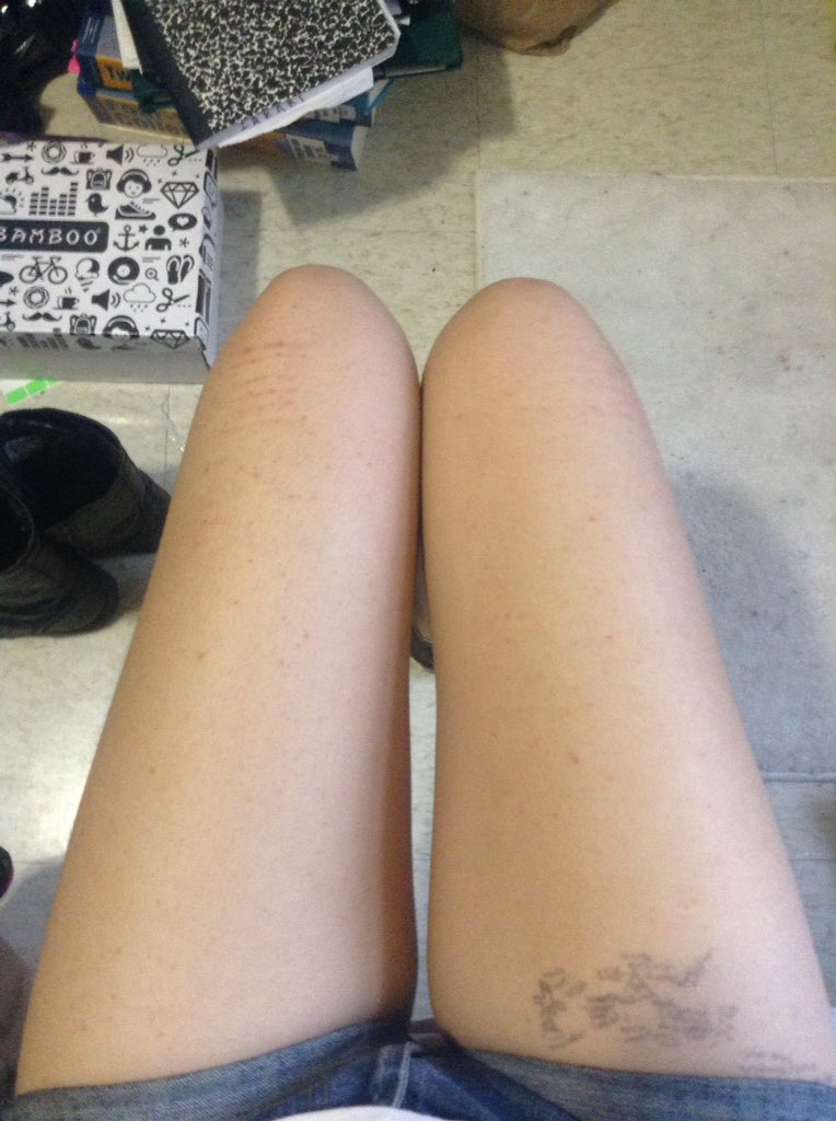 cravingxbones's tweet photo. some #picslips of my legs. these will be thinner by the end of July. https://t.co/DlE0SucKs7