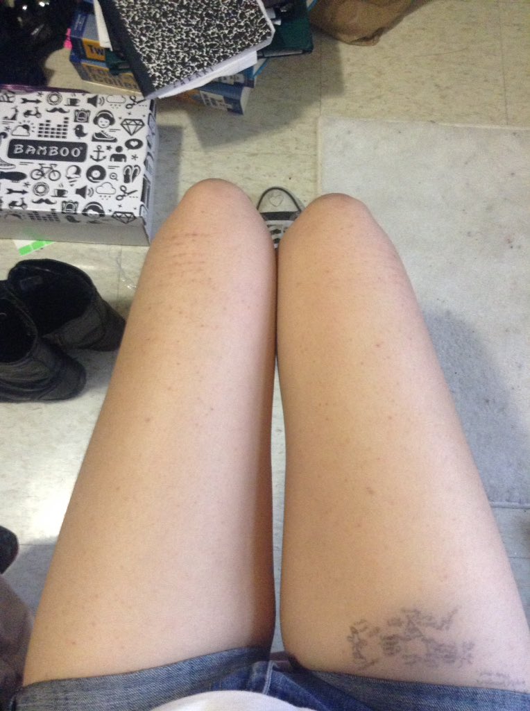 cravingxbones's tweet photo. some #picslips of my legs. these will be thinner by the end of July. https://t.co/DlE0SucKs7