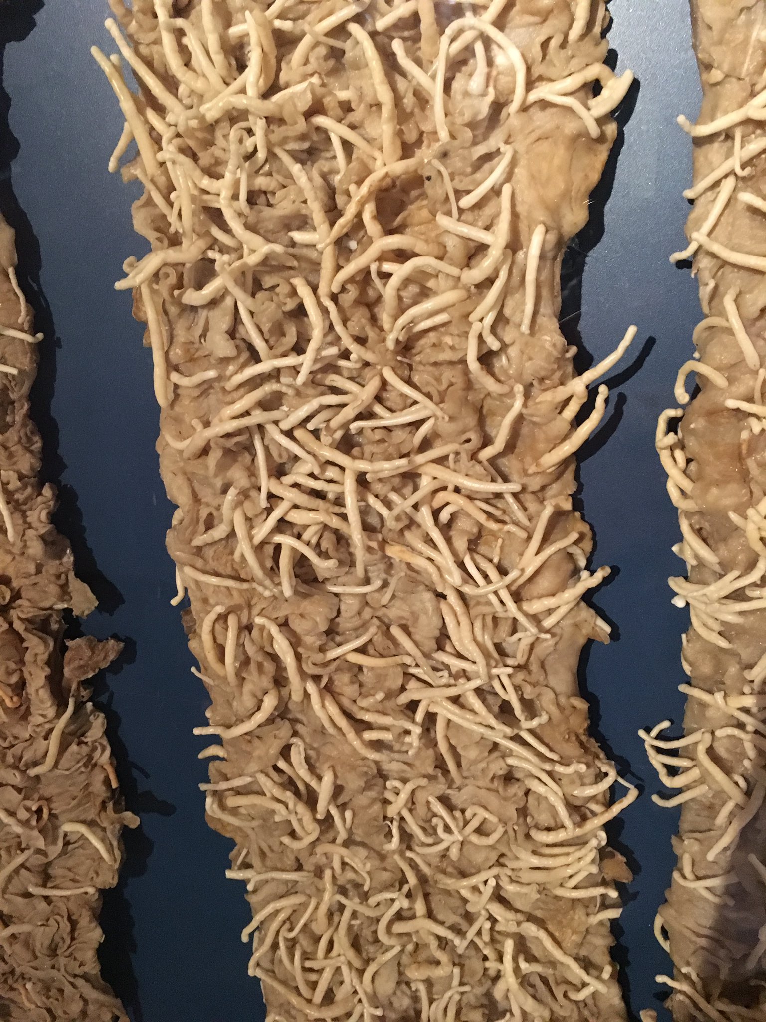 セノビック 薄毛に良いもの探してます V Tvittere 鯨の腸の中 アニサキス等寄生虫の住処らしい 私の好きな鯖も奴らに寄生されてるなんて 寄生虫 T Co Imeg11iqmh Tvitter