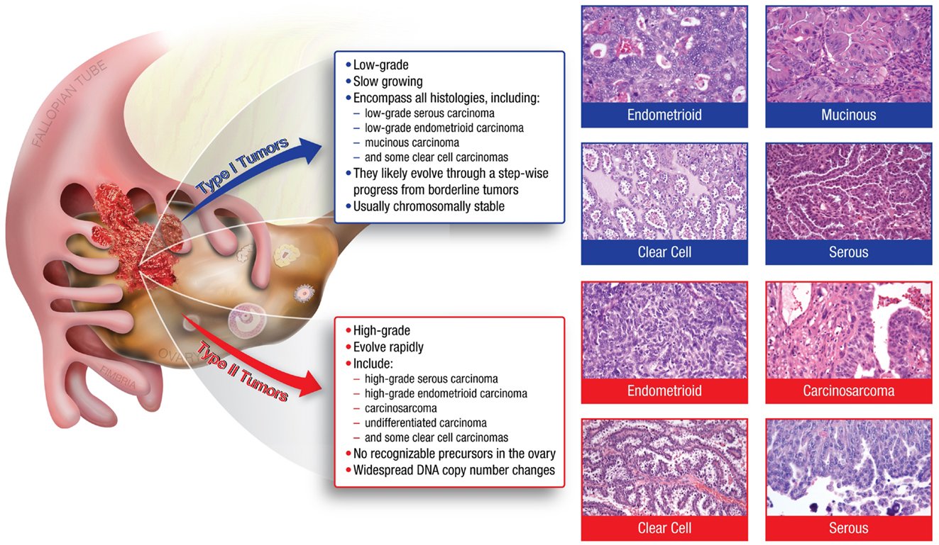 Tumor borderline esperanza de vida