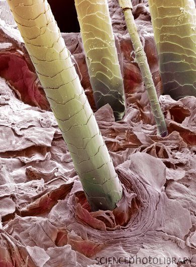 medicalce's tweet photo. Human hair, colored SEM. Hair shafts growing from the surface of human skin. https://t.co/ypsu91TW6u