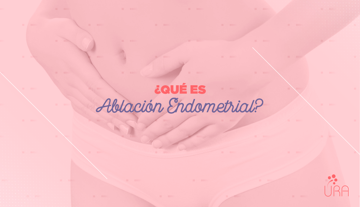 URAClinica's tweet photo. Se usa para tratar problemas de hemorragias uterinas de causa benigna. Da clic aquí: https://t.co/D7k1zHCPhV https://t.co/Ueg8FAc8Du