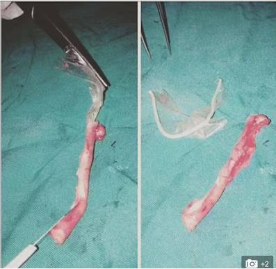 Djstunar's tweet photo. [F9T GIST] Woman Complains Of Stomach Pain , What Doctors Found Inside Is Shocking ||… https://t.co/ESNpVIFq8t https://t.co/uesaDq0j8Q