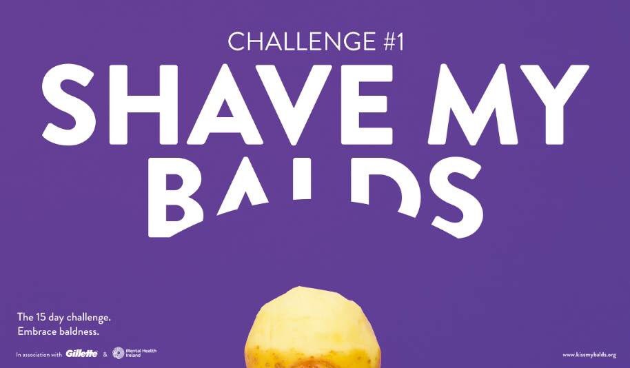 BonanzaLand2017's tweet photo. 'Kiss my Balds' The 15 Day Challenge to Embrace Baldness! By Dylan Hodge #IADTGradShow #FutureProofed16 https://t.co/HVlyYdurkM