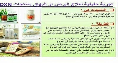 علاج البهاق في ساعة