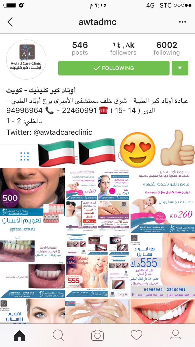 DeaiahA's tweet photo. 👍🏼😍🇰🇼🇰🇼🇰🇼يستاهلون التميز من حق الكويت تفتخر #الكويت #السعوديه #اسنان #جمال #صحه #رمضان https://t.co/Ztm1CtPNFX