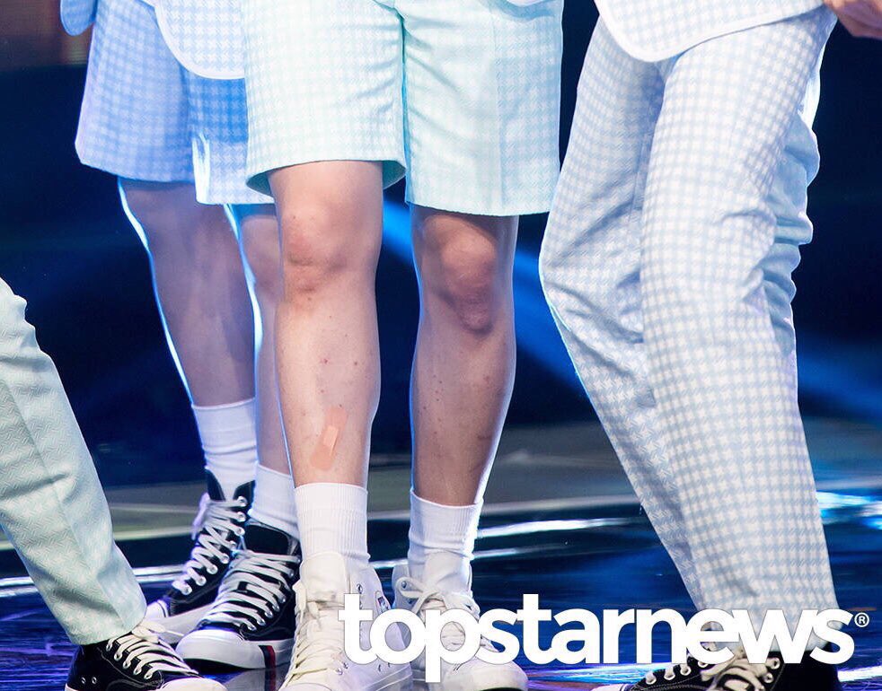 save_boo's tweet photo. 울 애긔 저 상처때문에 밴드 붙였었나봐 ㅠㅠㅠㅠㅠㅠㅠㅠㅠㅠㅠㅠ 오디서 상처났어ㅠㅠㅠㅠㅠ ㅁ ㅠ ㅠㅠㅠㅠㅠㅠ https://t.co/romIPn8EjA