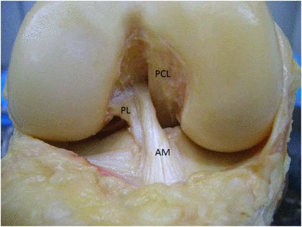 #ACL reconstruction in youth athletes leads to improved return to play #sportsmedicine ow.ly/m3Dt300lQjJ
