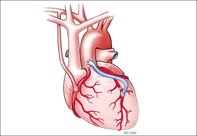 Cleveland Clinic MD tweet media