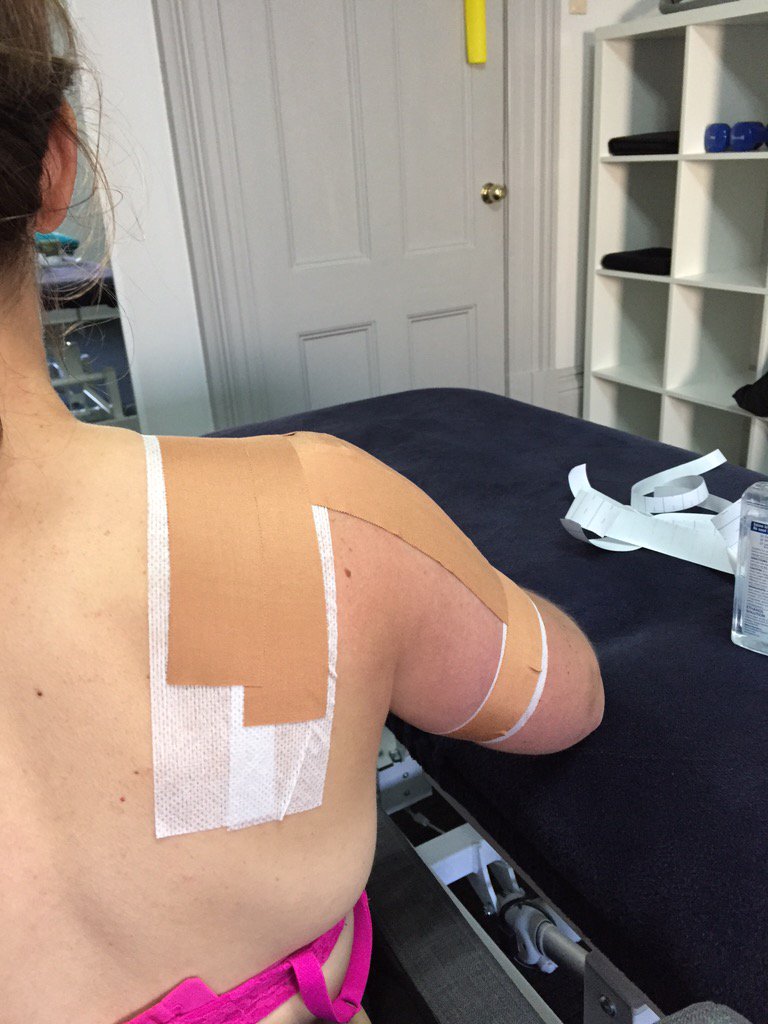 aspirephysio_sa's tweet photo. Shoulder injuries from netball? We treat that! Open tomorrow 8am-6pm 👉book online at our website👈👋 https://t.co/b9UfPaC854