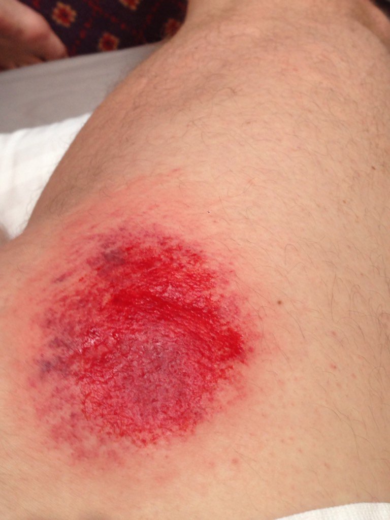Day1@dallagliofoundation cycle slam, found the oil on the wet road! @taylorsport

uk.virginmoneygiving/adrianbridge