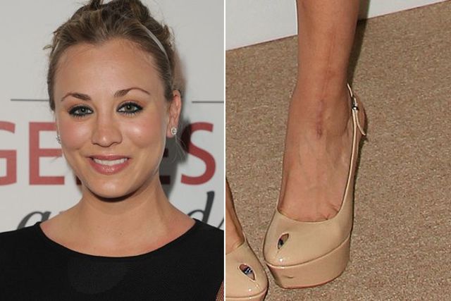 WTrendsInfo's tweet photo. These 11 Scarred Celebrities Have Incredible Stories About Their Famous Marks
https://t.co/jGiFOde60L https://t.co/bfKiSe2ypT