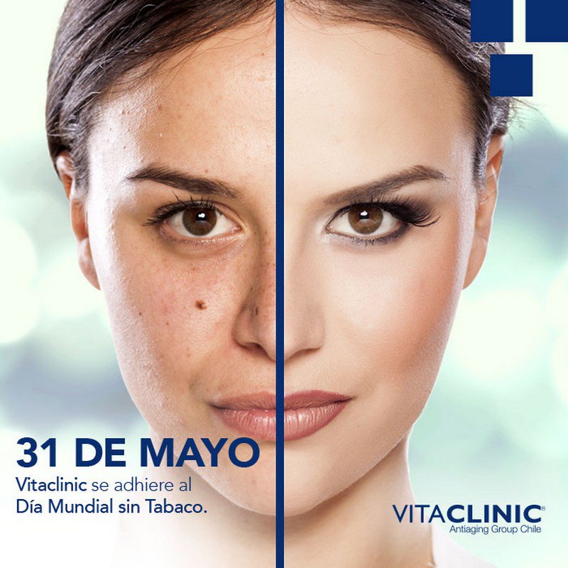 VITACLINICChile's tweet photo. Cada 31 de mayo, la OMS celebra el Día Mundial del no fumador. 
#DíaMundialSinTabaco https://t.co/x8WHebeuxg