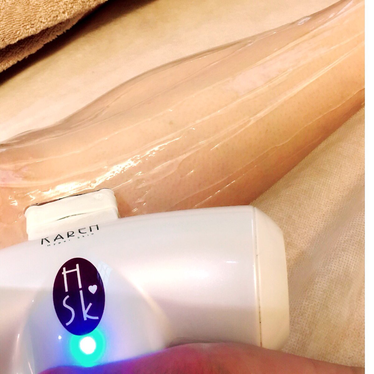 YukaMmmmwwmmmm's tweet image. 足の脱毛☝🏻️脱毛というより
ムダ毛の予防&amp;amp;毛穴レスの肌へのお手入れ😆 毛がなくなるだけでなく肌がきれいに😉これぞ #ハイパースキン脱毛 #KAREN #エステサロン #毛穴レス