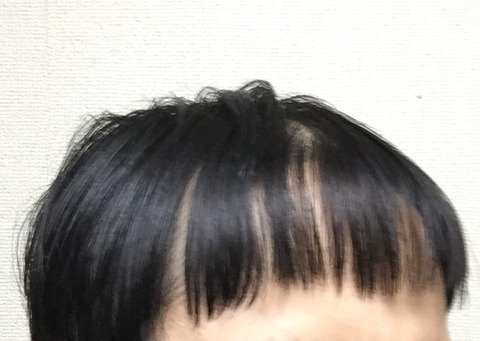 はげのつぶやき Hage Tweet Twitter はげのつぶやき Hage Tweet Twitter