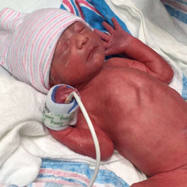 celinalanders's tweet image. Don't understand how people push out full term babies bc this one almost killed me.. But it's okay 💖