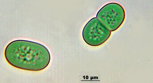 RosaGencarelli's tweet photo. Cyanobacteria, specifically the Synechococcus species ..aka blue green algae #genewizweek #weirdestorganism https://t.co/CkG6fEFAxx