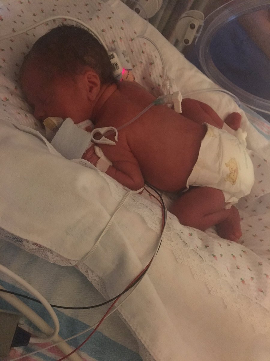 celinalanders's tweet image. My little human bean. I'm sorry she's just so cute