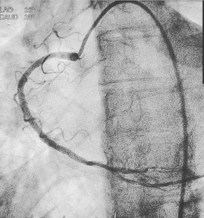 TracyTerrones's tweet photo. Cath lab ❤️ https://t.co/QIqNFuprof