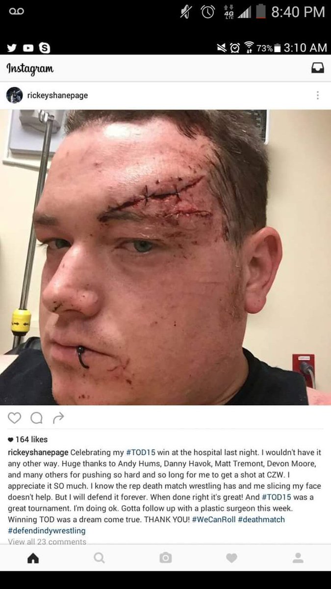 freeway_chris's tweet photo. #ProWrestlingIsReal #DeathMatchStyle #TOD15 #DefendIndyWrestling @RickeyShanePage https://t.co/tCC2PA81dA