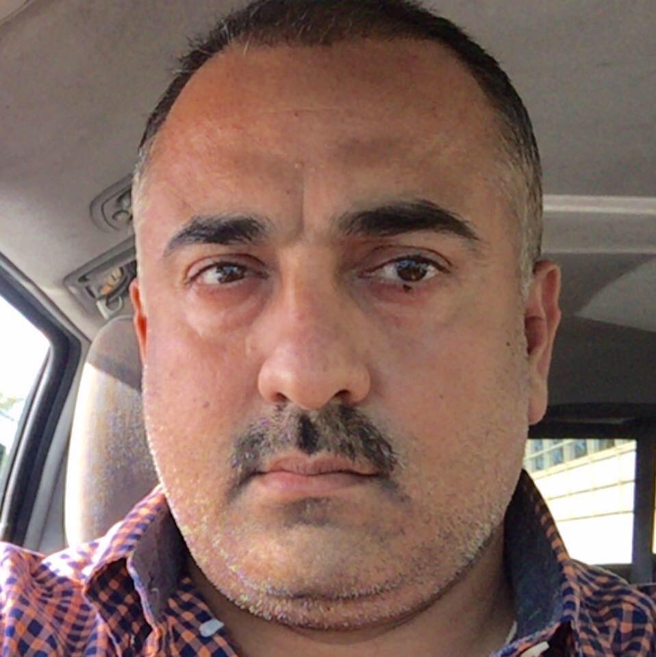 HairMultan's tweet image. The best Hair transplant non should stare at