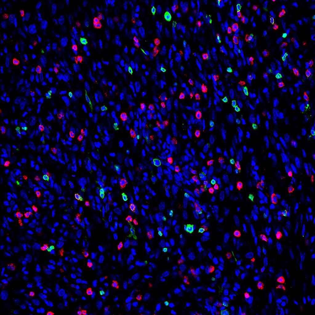 EPFL_en's tweet image. Researchers reclaim immune cells corrupted by tumors actu.epfl.ch/news/reclaimin… #epflSV #Macrophages