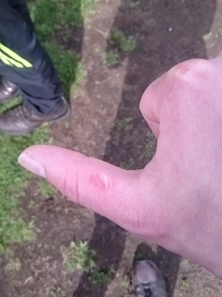 ann2k16's tweet photo. Flesh wound after a lovely row on #Windermere #BAC16 https://t.co/x3VT8XCxEL