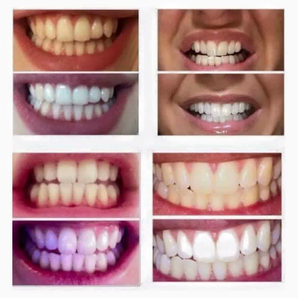 LuloBeauty's tweet photo. #ToothpasteTuesday order your toothpaste today and receive a FREE breath spray 💙 https://t.co/unNJTRZoF8