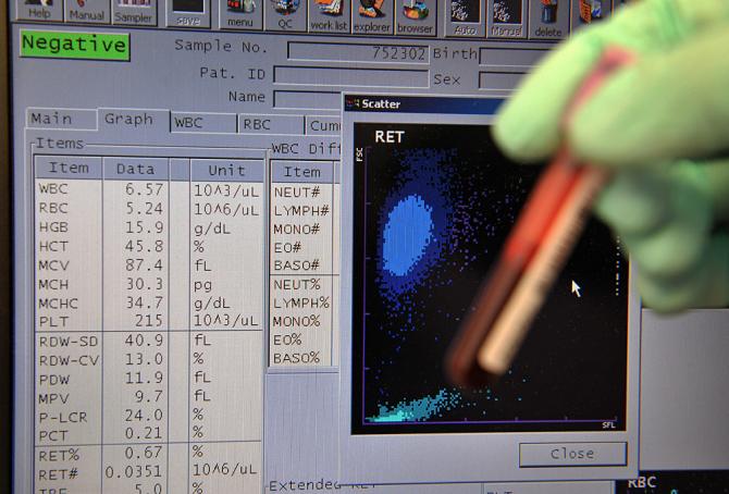 Dr Bonar whistleblower says doping is 'endemic' in cycling: buff.ly/1XViYIa