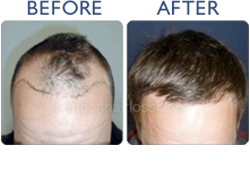JeyGarrick's tweet photo. Can PCOS And Hair Thinning Really Be Related? By E... -> https://t.co/CP50k6jEyu
#hairgrowfaster https://t.co/HqzGfR1GOR