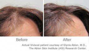 JeyGarrick's tweet photo. What Causes Hair Loss In Men? -> https://t.co/HhZGa1Tu8A
#hairgrowthtreatments https://t.co/dcp3bOhcQK
