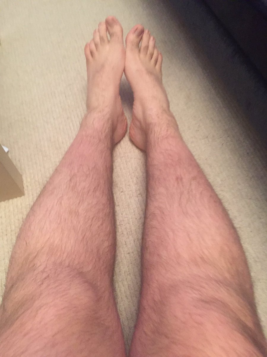 welshsquizz's tweet photo. Right then seeming that's refs done... All there is now is to shower and sort these legs out! 😳 #athletesproblems https://t.co/tJwAFvblT0