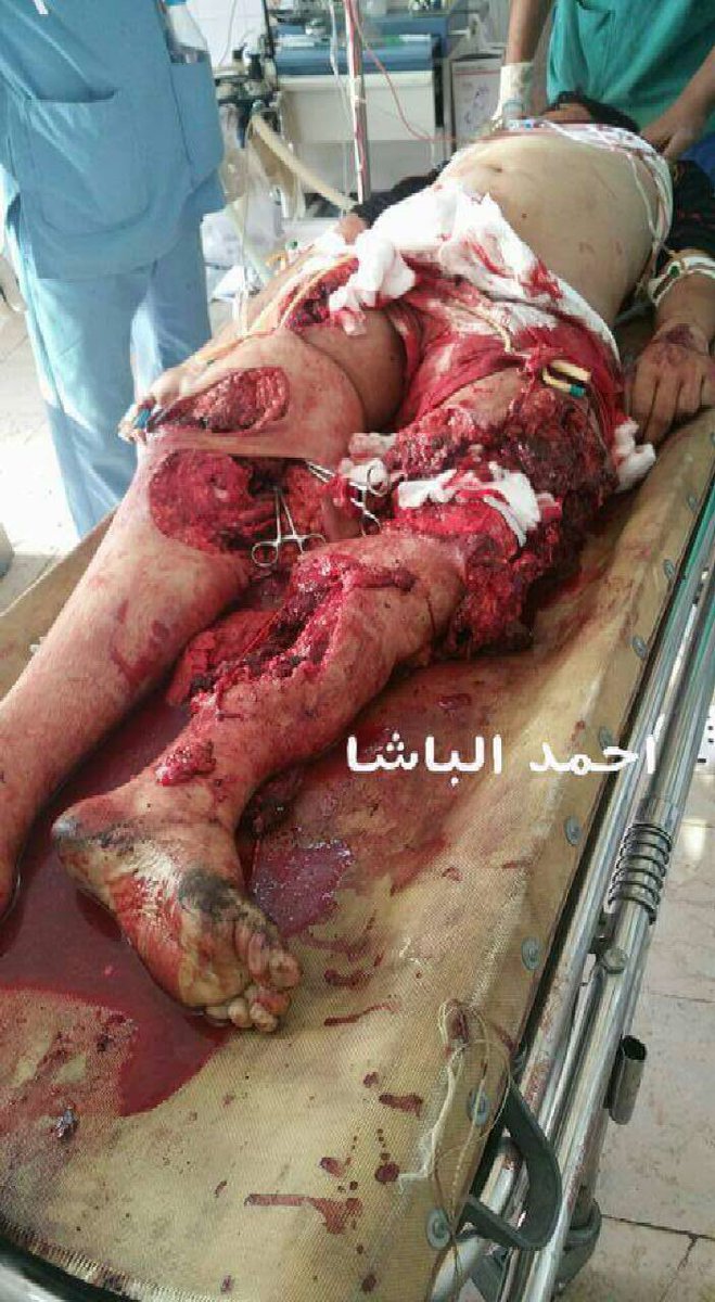 almekhlafi59's tweet photo. هذا هو شهر رمضان عند دعاة المسيرة القرأنية ، مجرمي الحرب  واصحاب الادعاءات الكاذبة ، قتلة العزل . مجزرة في سوق شعبي https://t.co/cT3ugXNP8r