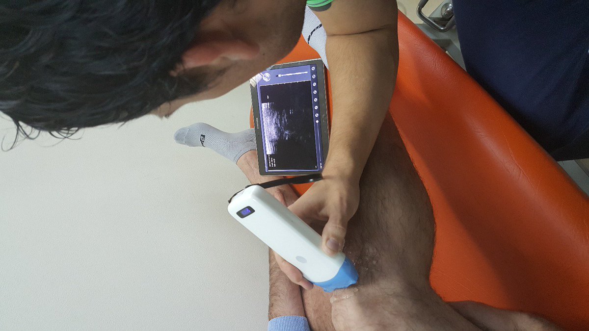 Ecografo WiFi ultraportatil