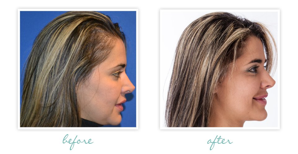 JeyGarrick's tweet photo. What Makes My Hair Grow Faster? Find Out! -> https://t.co/3kkkrVs4Mp
#hairgrowthforyou https://t.co/rbBFZsAuGI