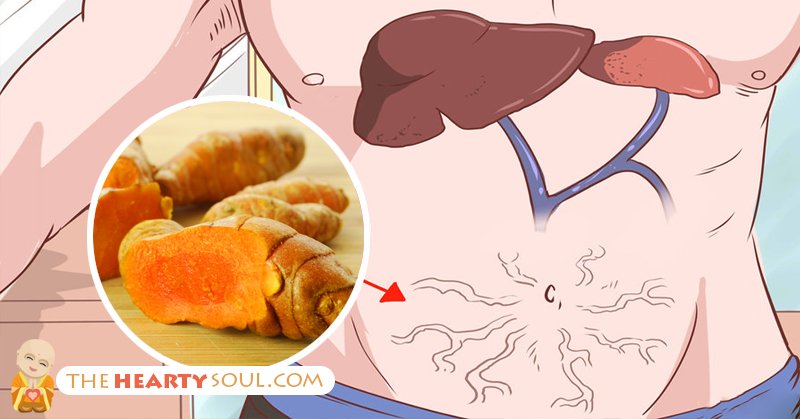 10 #natural remedies for #fattyliver!  Read here: qoo.ly/9cayj/0 <a href="/theheartysoul/">The Hearty Soul</a> #Rochester #health #NY