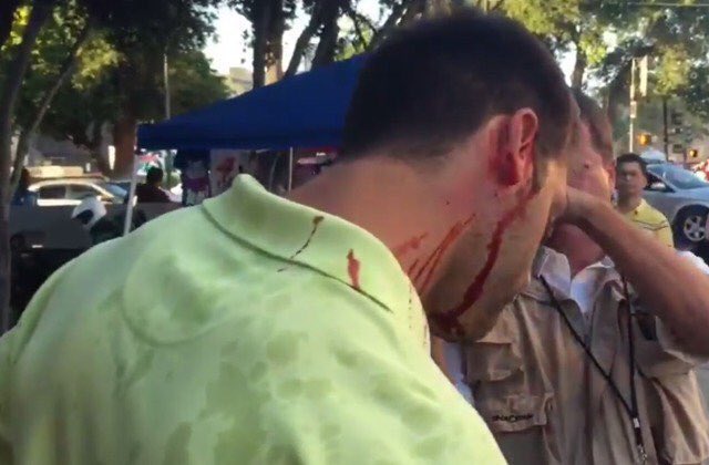 cristinalaila1's tweet photo. Trump supporter attacked👉🏻media silent. If he were a Muslim, there would be lawsuits &amp; it would be a hate crime! https://t.co/wgcFx1uXGB