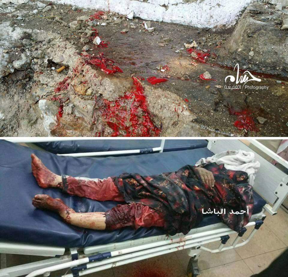 fdelhomidi's tweet photo. الى لقالقة تعز وحريم السلطان اتركو عيدروس وشلال ووجهو اقلامكم واصواتكم لمن يقتل الأبرياء ولاطفال ونساء في تعزالجريحه https://t.co/GXaFg7RoWX