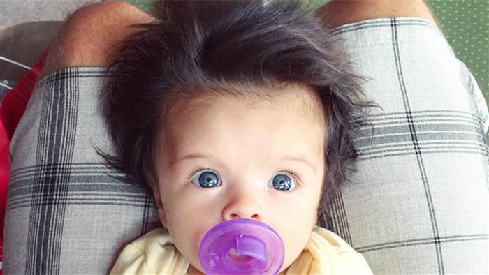 TODAYshow's tweet photo. Baby's 'glamorous' head of hair takes internet by storm https://t.co/OSih6fLM92 https://t.co/SpQTkeepB4