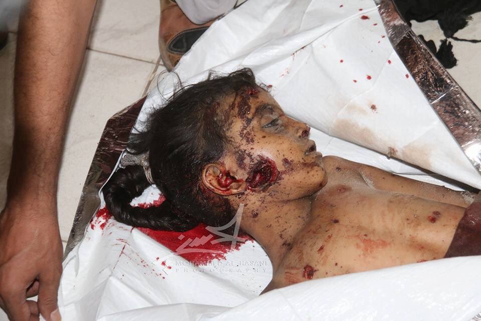 BinmubarakAhmed's tweet photo. #Houties_militias  shelled civilians in Taiz.
#Houthies_crimes. https://t.co/A7Yg8Ff85M