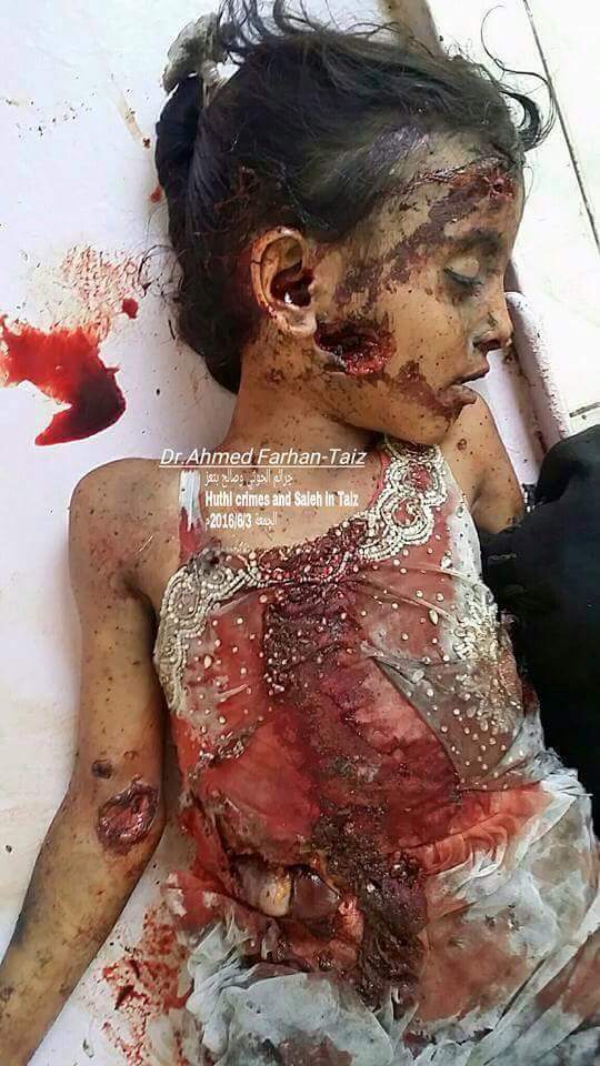 TAIZ_NOW's tweet photo. #تعز
الحوثي وعفاش الذي يرتكبون هذه المجازر ليسو ارهابيين في نظر الامم المتحده
بينما التحالف  الذي اتى لانقاذهم مدان؟ https://t.co/9mtzSAWXO4