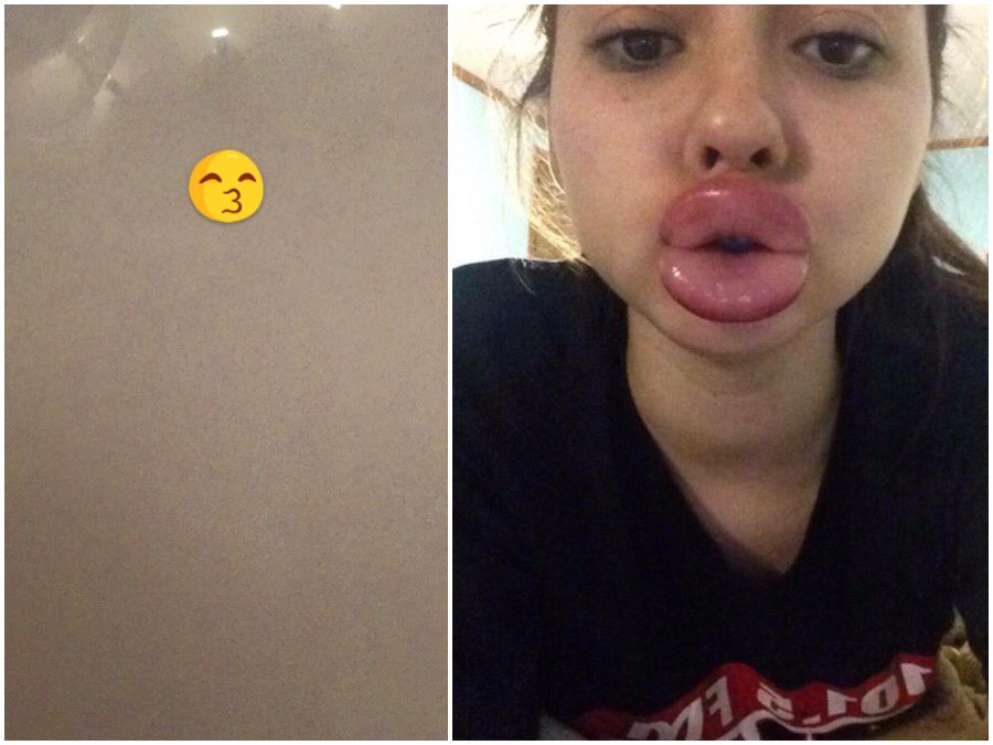 Wxthim's tweet photo. Qd les emoticones #Facebook sont jaloux et veulent des lèvres pulpeuses comme #KellyJenner ptdrrr https://t.co/KZ6X73EAgh